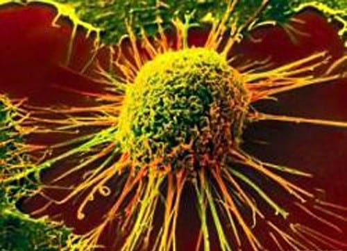 Des cellules “super-soldats” contre le cancer