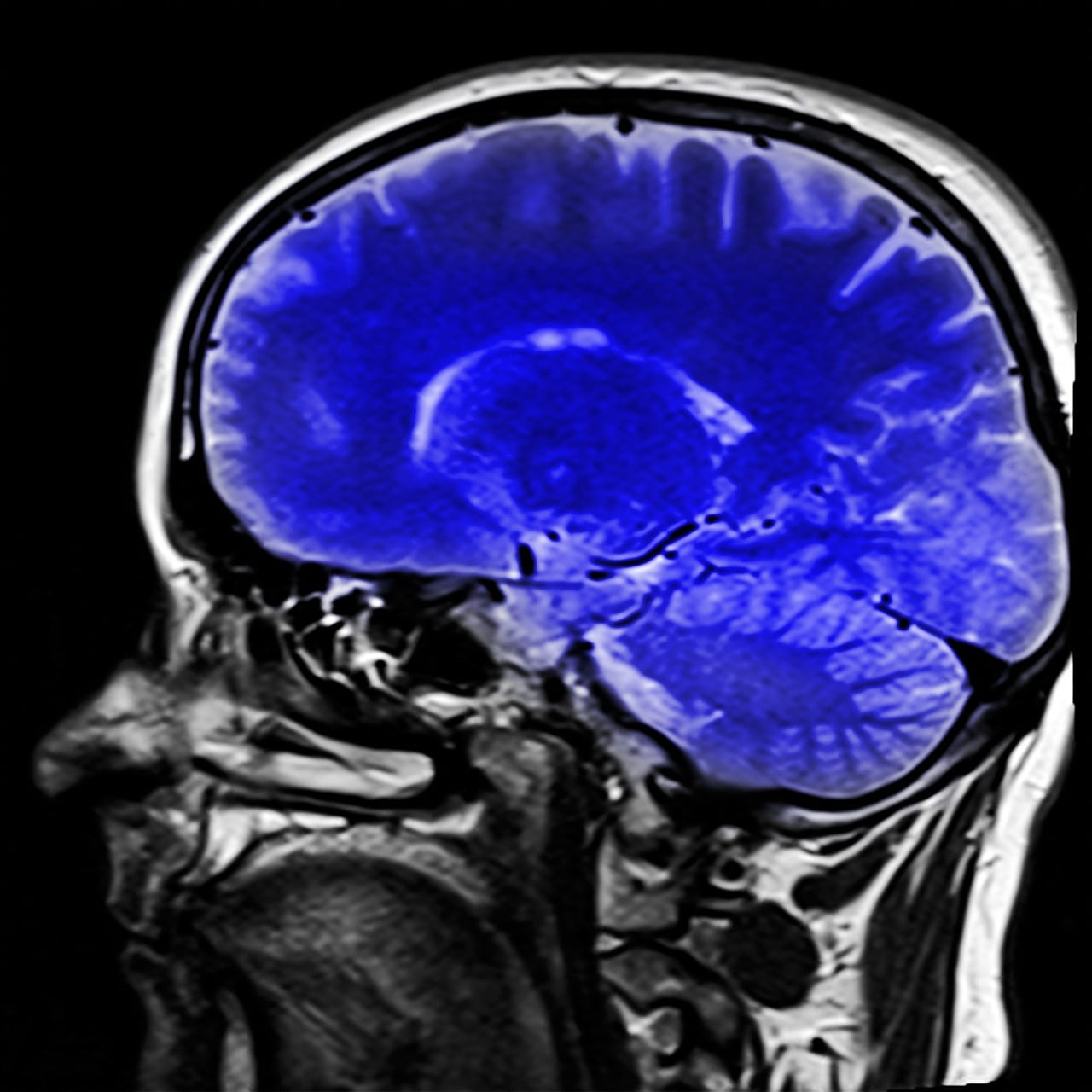 L’imagerie médicale peut désormais visualiser les vaisseaux sanguins cérébraux
